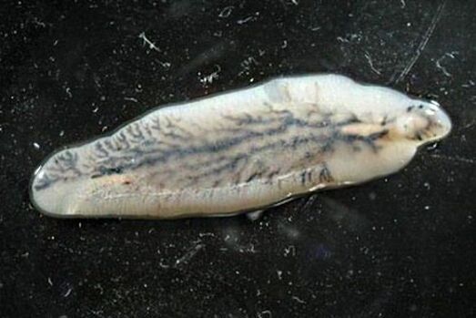 pečeňová motolice u ľudí