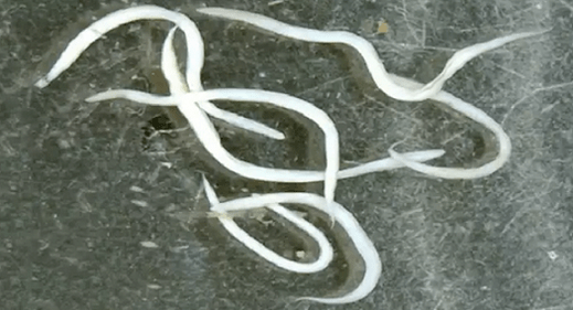 pinworms v ľudskom tele