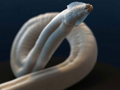 toxocara z ľudského tela