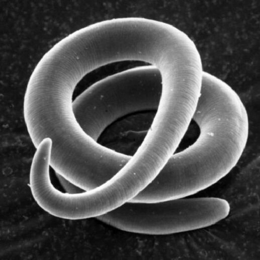 červ parazit trichinella u ľudí