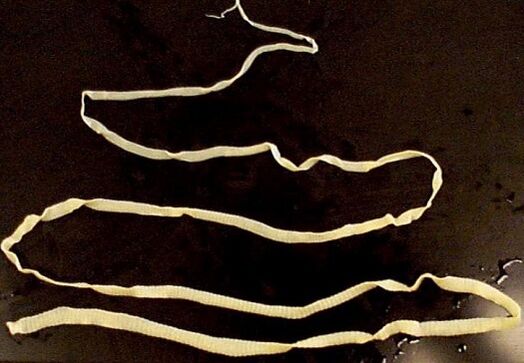 široká pásomnica z ľudského tela