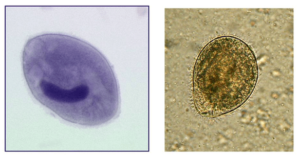Balantidia ciliates, parazituje v hrubom čreve